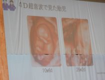 添付画像